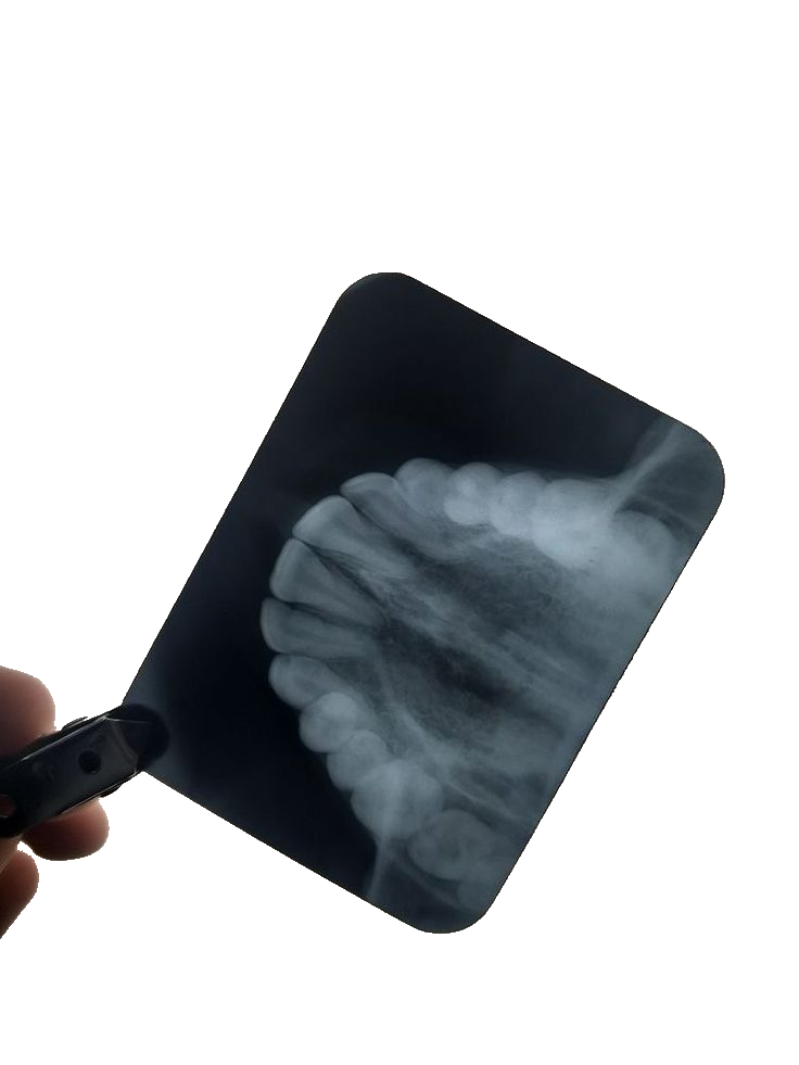 Рентгенодиагностика